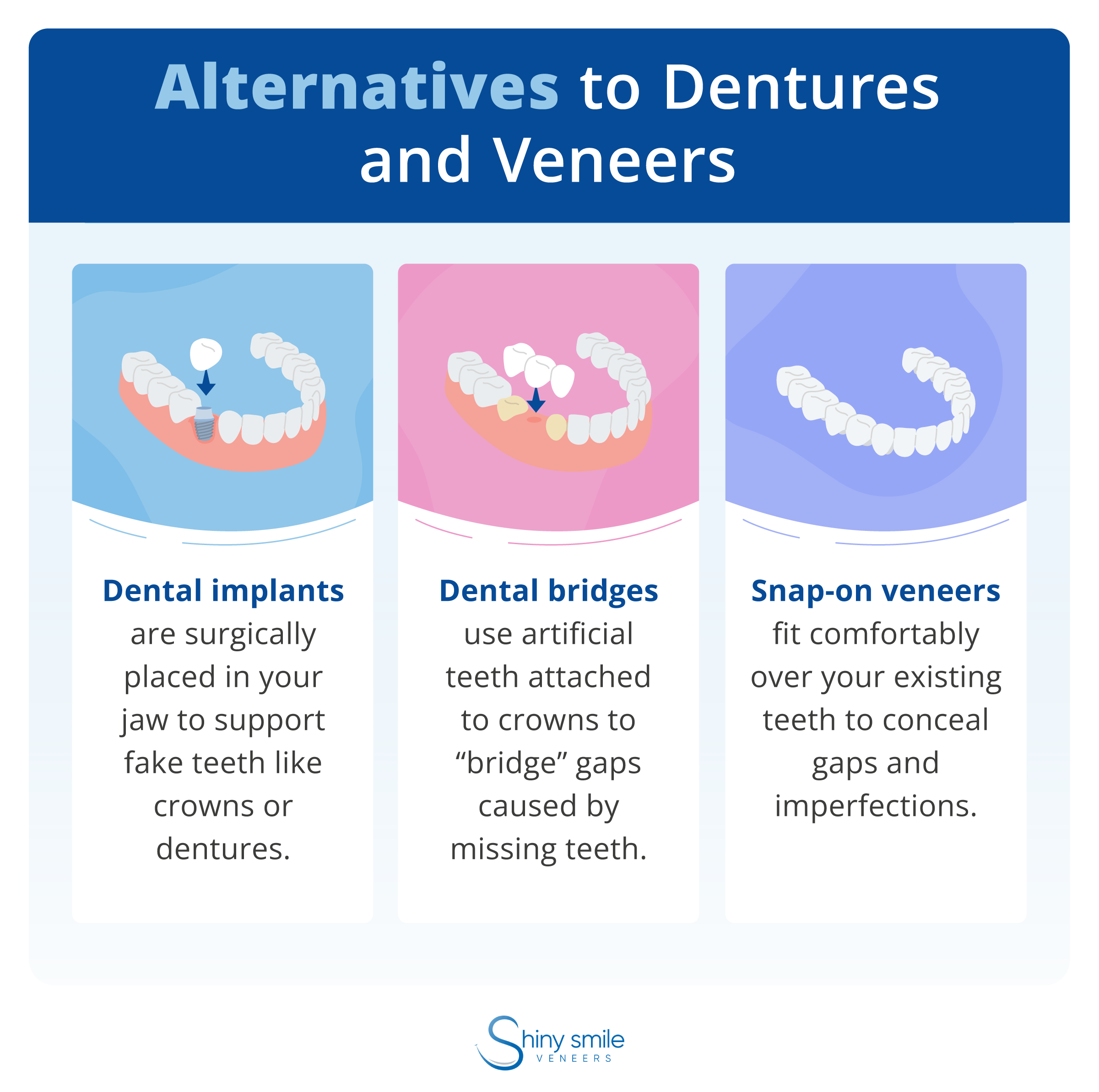 A list of alternatives to veneers and dentures