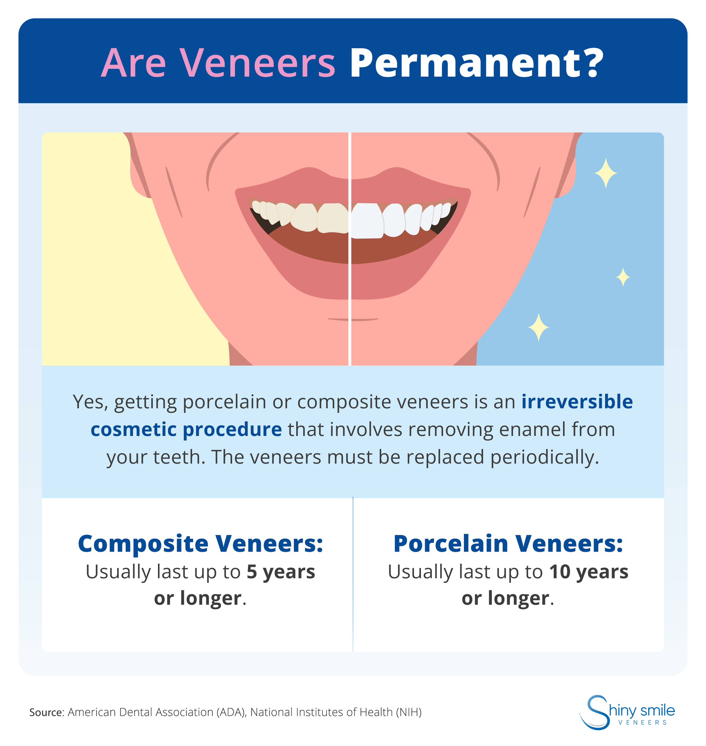 An explanation of why porcelain and composite veneers are permanent