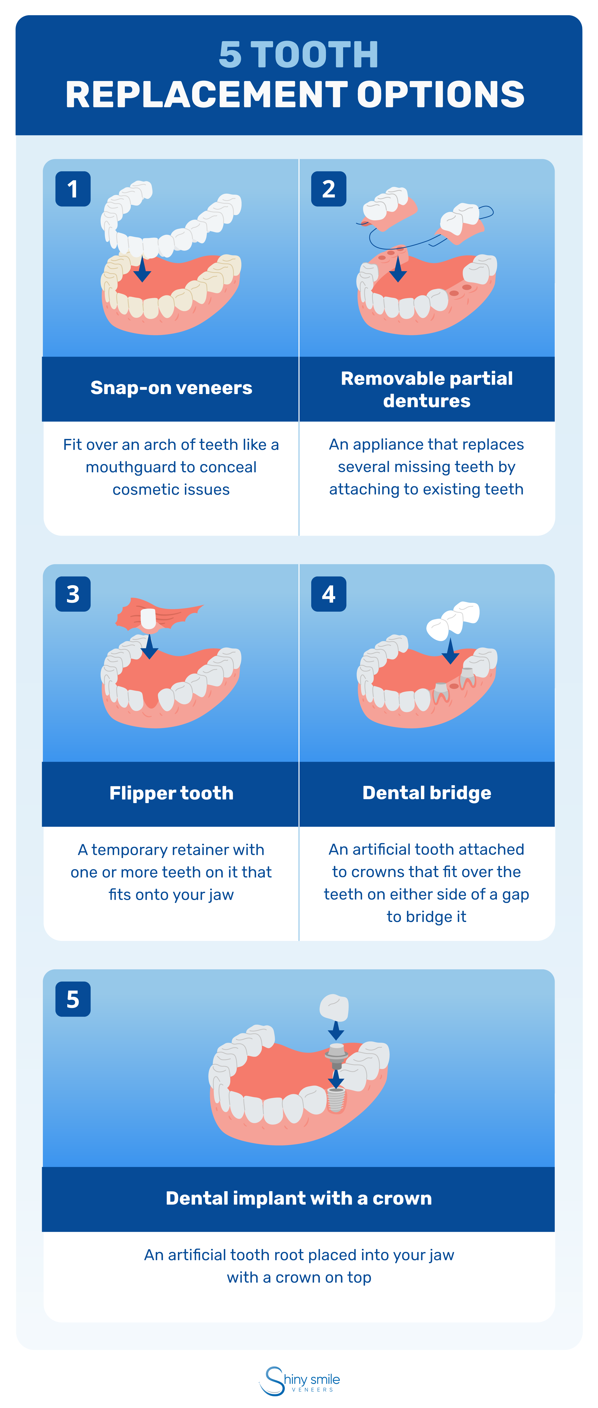 5 teeth replacement options