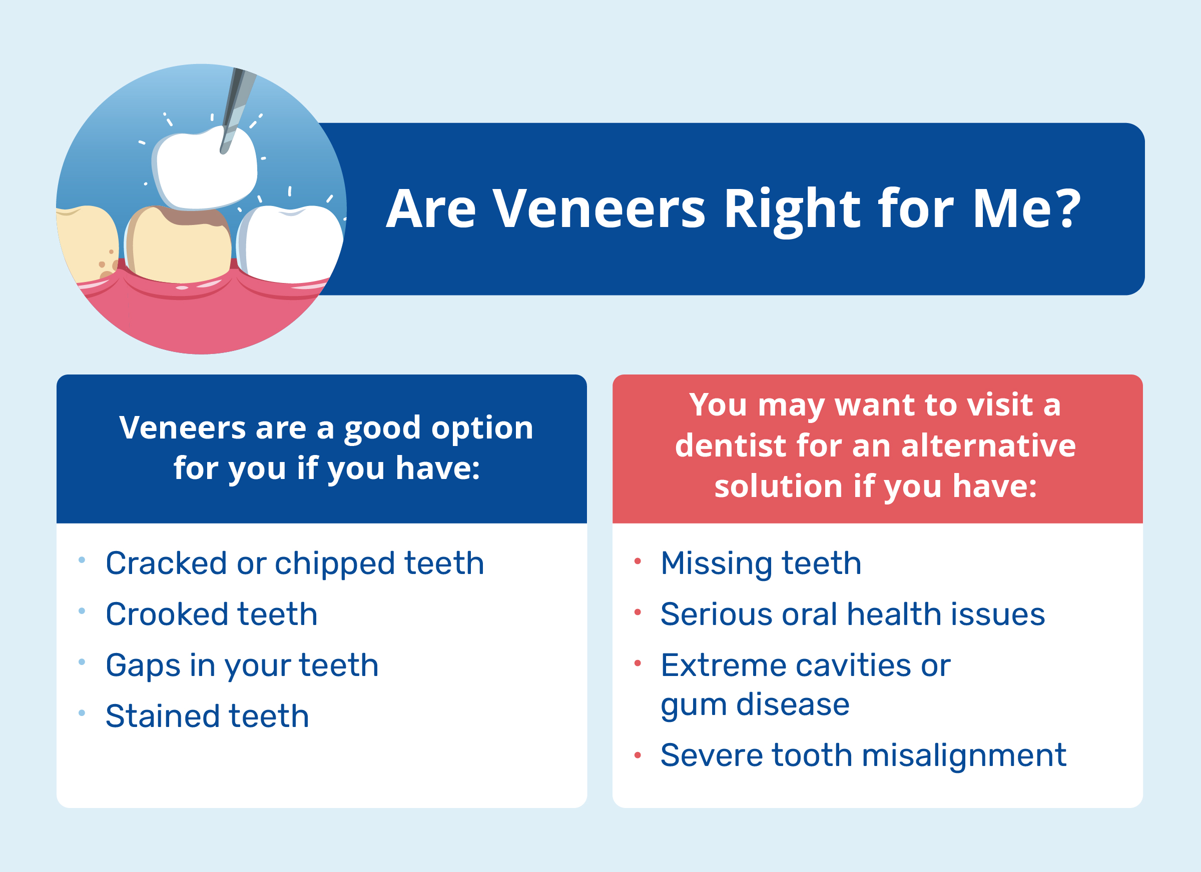 are veneers right for me