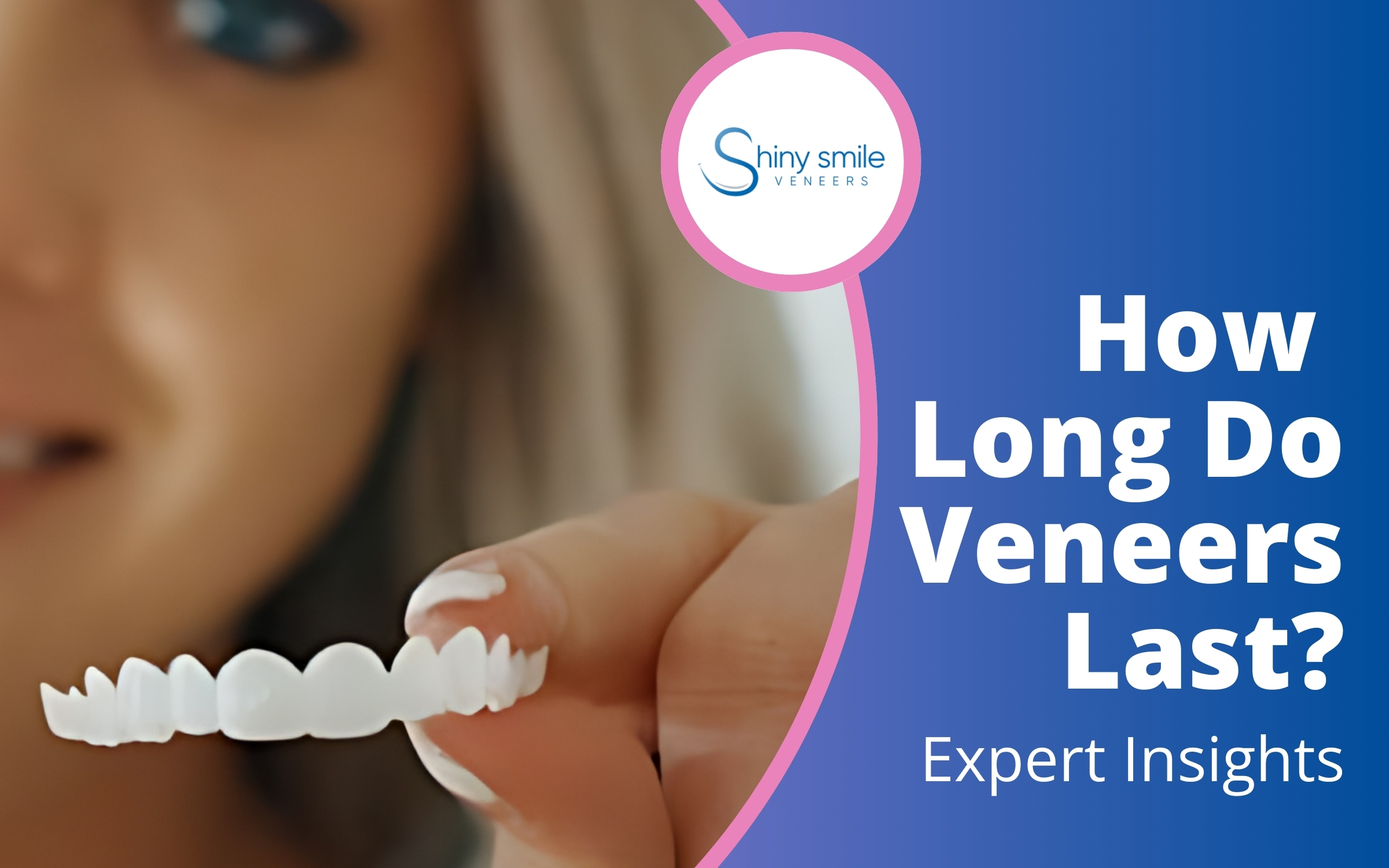 How Long Do Veneers Last