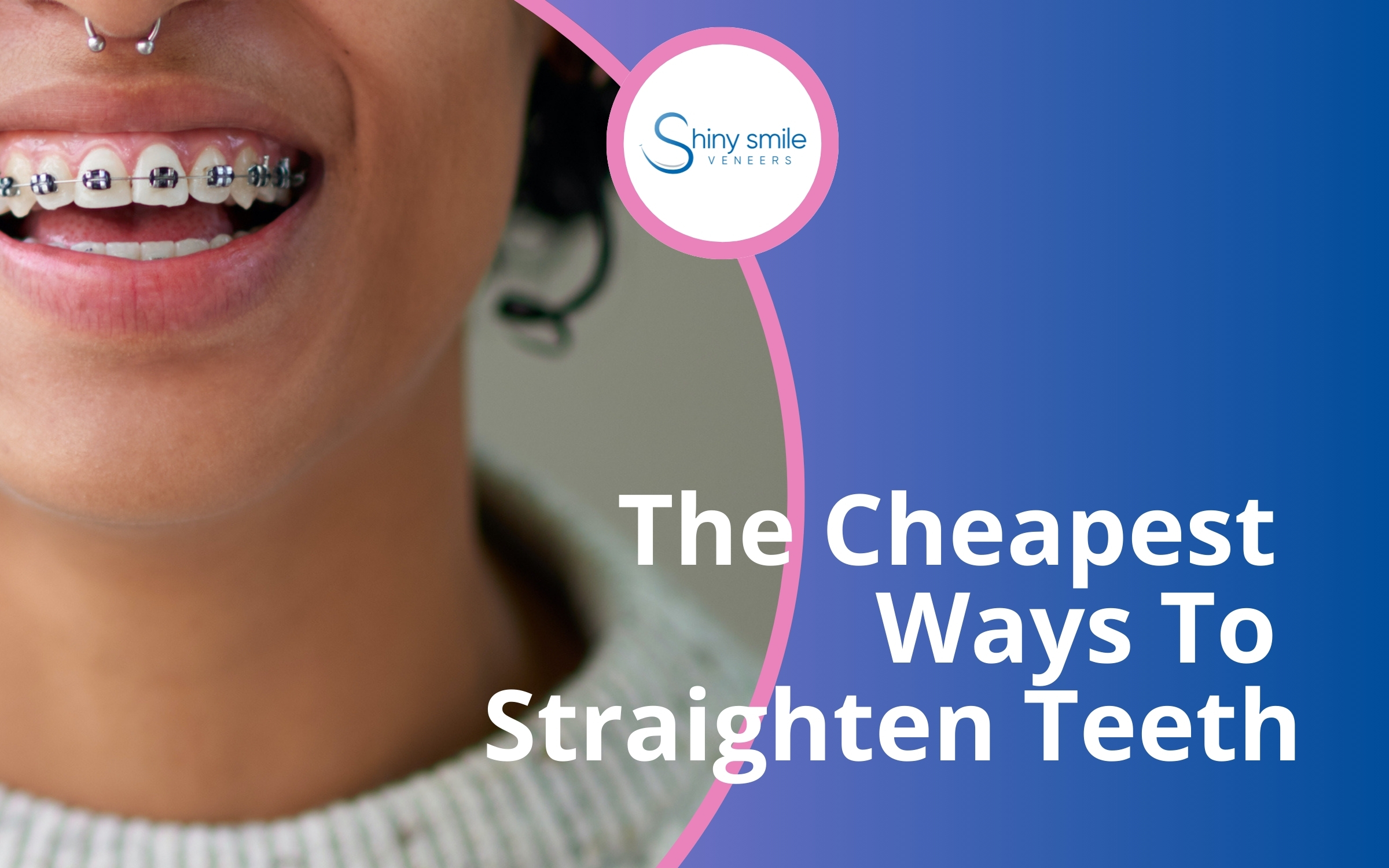 The Cheapest Ways To Straighten Teeth