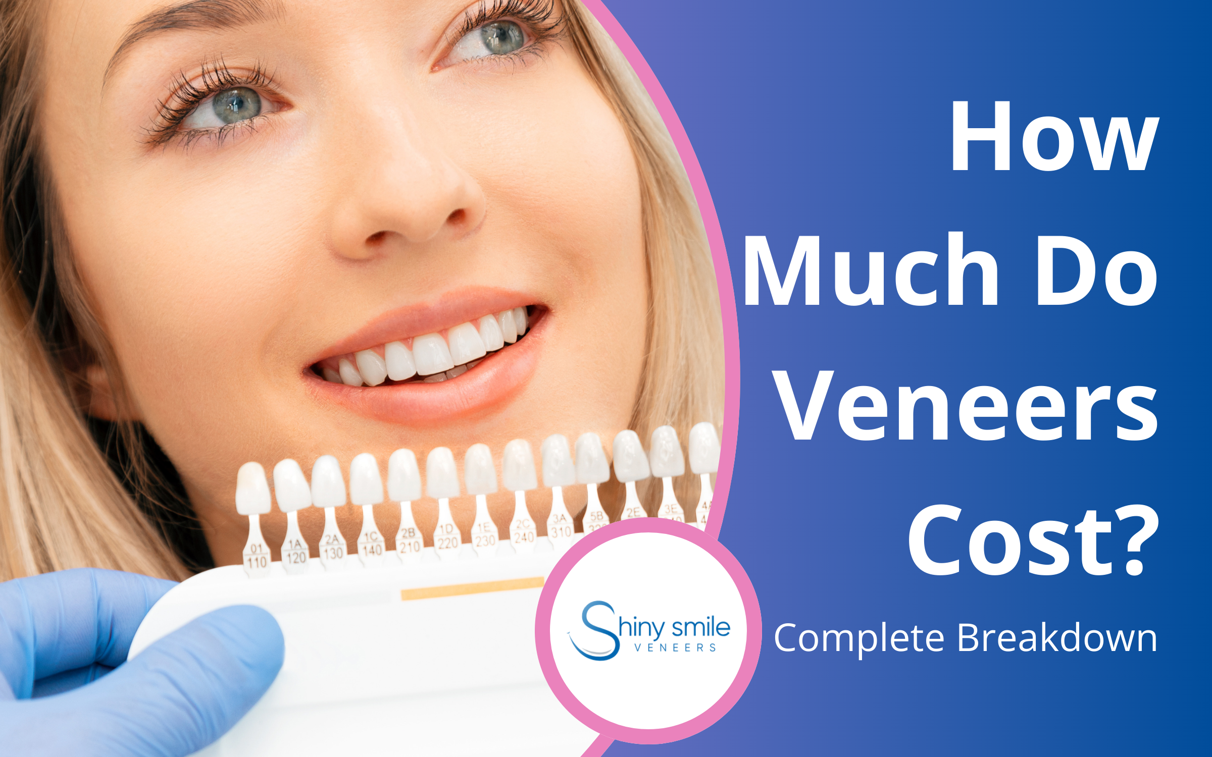 how much do veneers cost