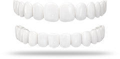 Top & Bottom Veneers